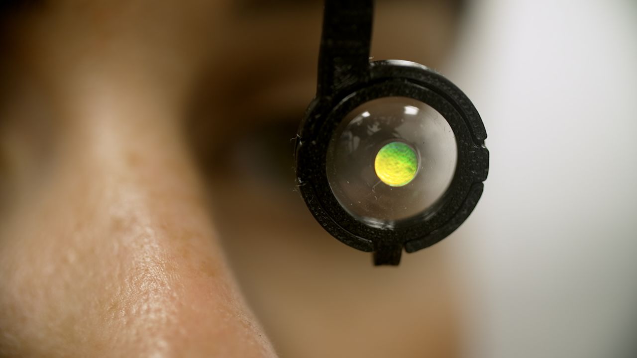 Smart contact lenses future technology